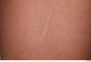 Arina Shy nude scar skin 0001.jpg
